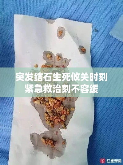 突发结石生死攸关时刻紧急救治刻不容缓