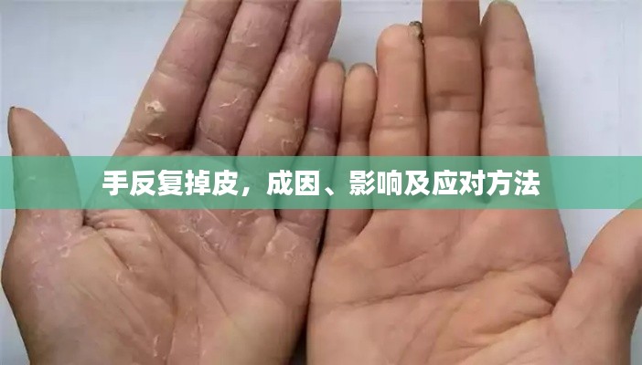 手反复掉皮，成因、影响及应对方法