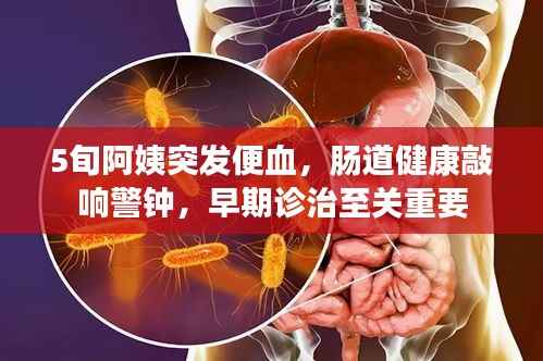 5旬阿姨突发便血,肠道健康敲响警钟,早期诊治至关重要
