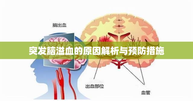 突发脑溢血的原因解析与预防措施
