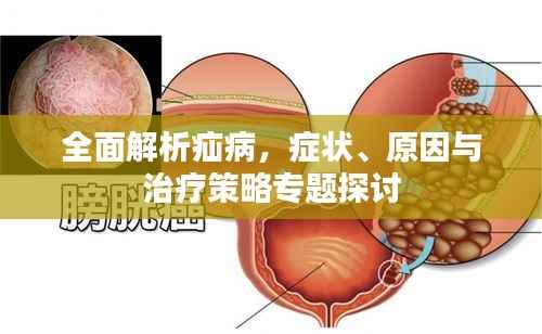 全面解析疝病,症状、原因与治疗策略专题探讨
